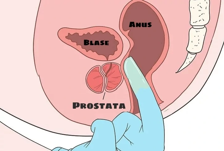Prostata massage